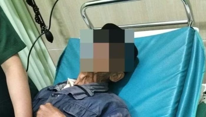 Kakek di Ngawi Datangi Damkar Minta Tolong Lepaskan Paralon yang Jepit Kemaluannya