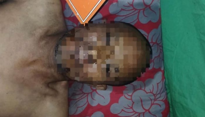 Polsek Perbaungan Evakuasi Penemuan Mayat Pria di Pajak Baru, Tidak Ditemukan Tanda Kekerasan