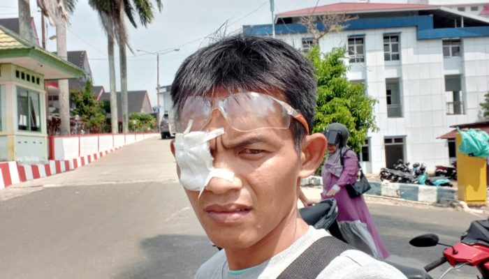 ‎Seminggu Tertahan di RS Rafflesia, Buruh Harian PTPN Regional 1 Terancam Gagal Operasi Mata
